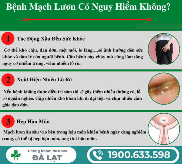 Hình ảnh minh họa